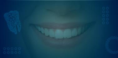 Teeth Whitening, take home kit